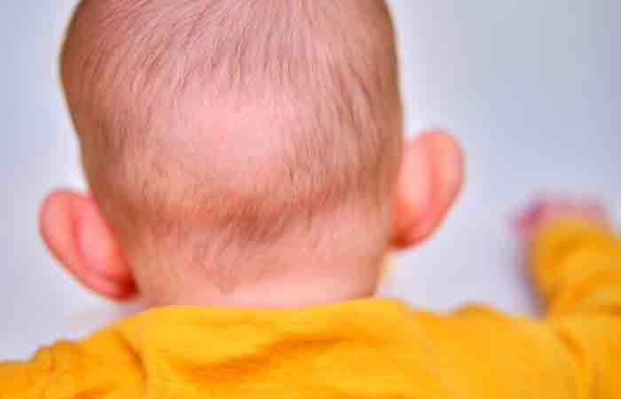 Newborn-Hair-Loss